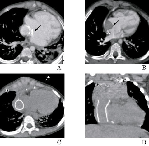 Consideration of the Pathological Features of Pediatric Congenital ...