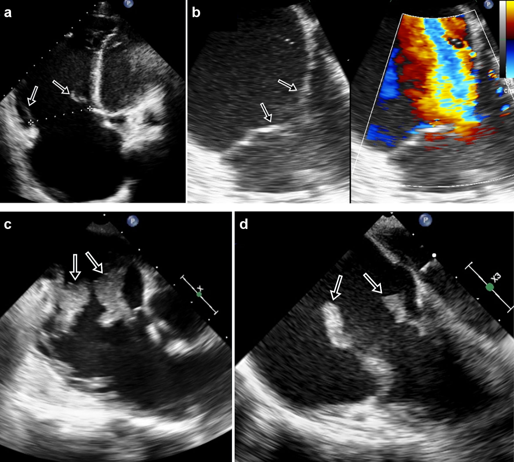 Cardiol Res